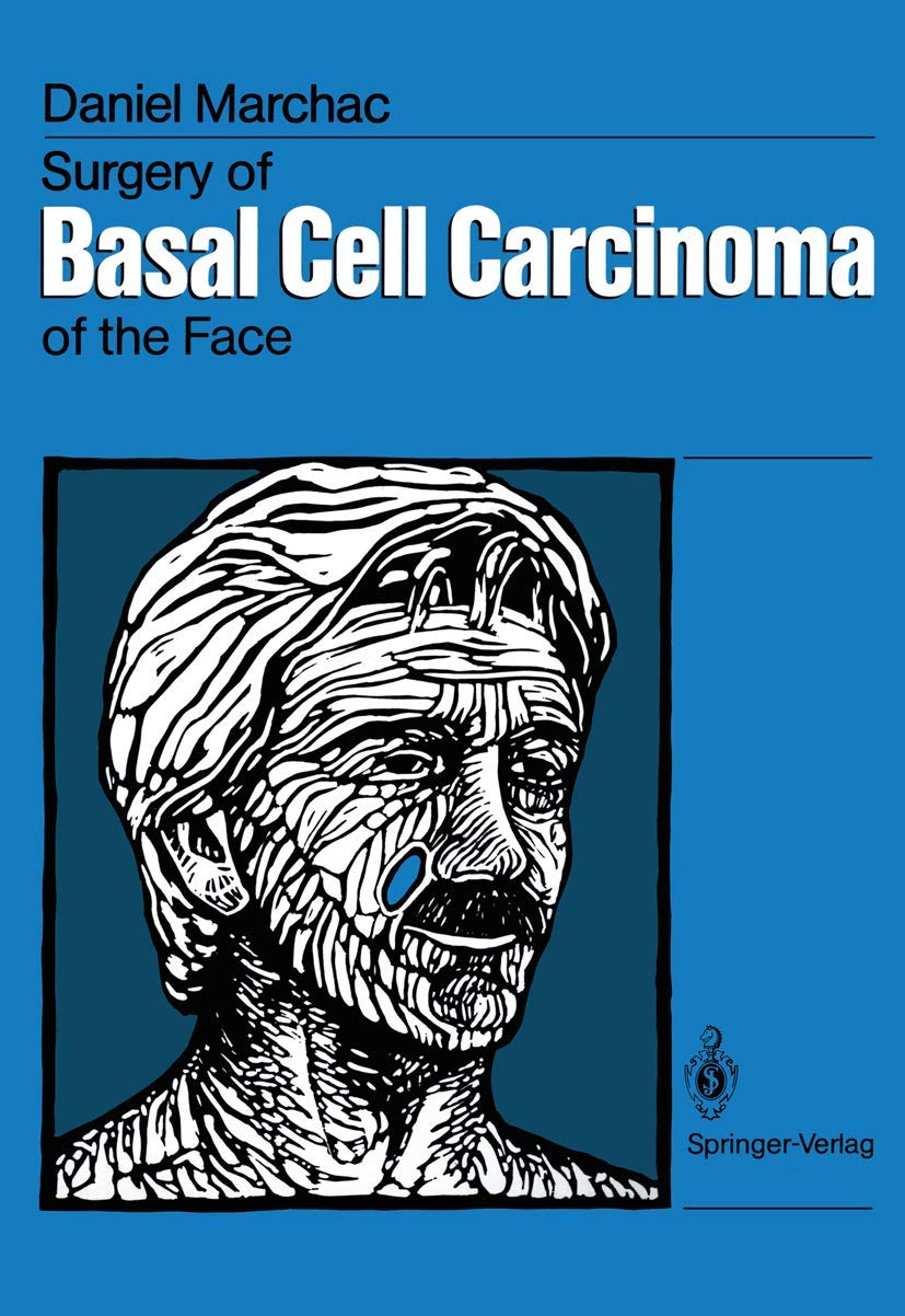 Surgery of Basal Cell Carcinoma of the Face Medicine