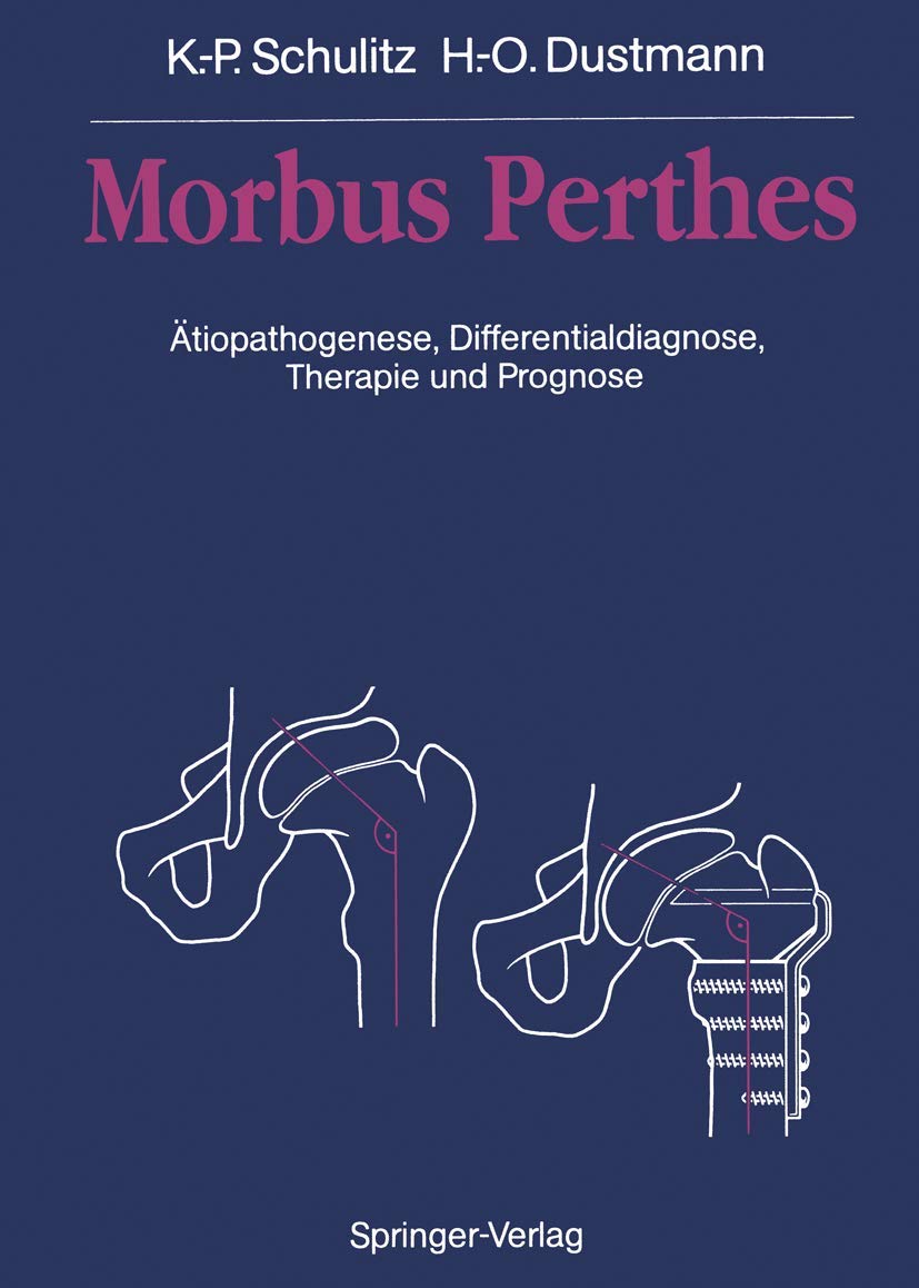 Morbus Perthes: Ätiopathogenese, Differentialdiagnose, Therapie und Prognose Medicine