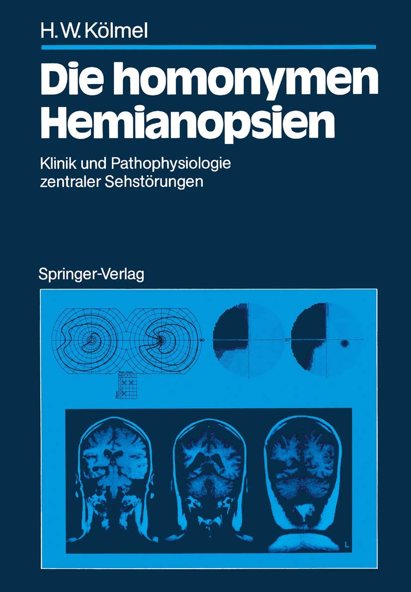 Die homonymen Hemianopsien Medicine