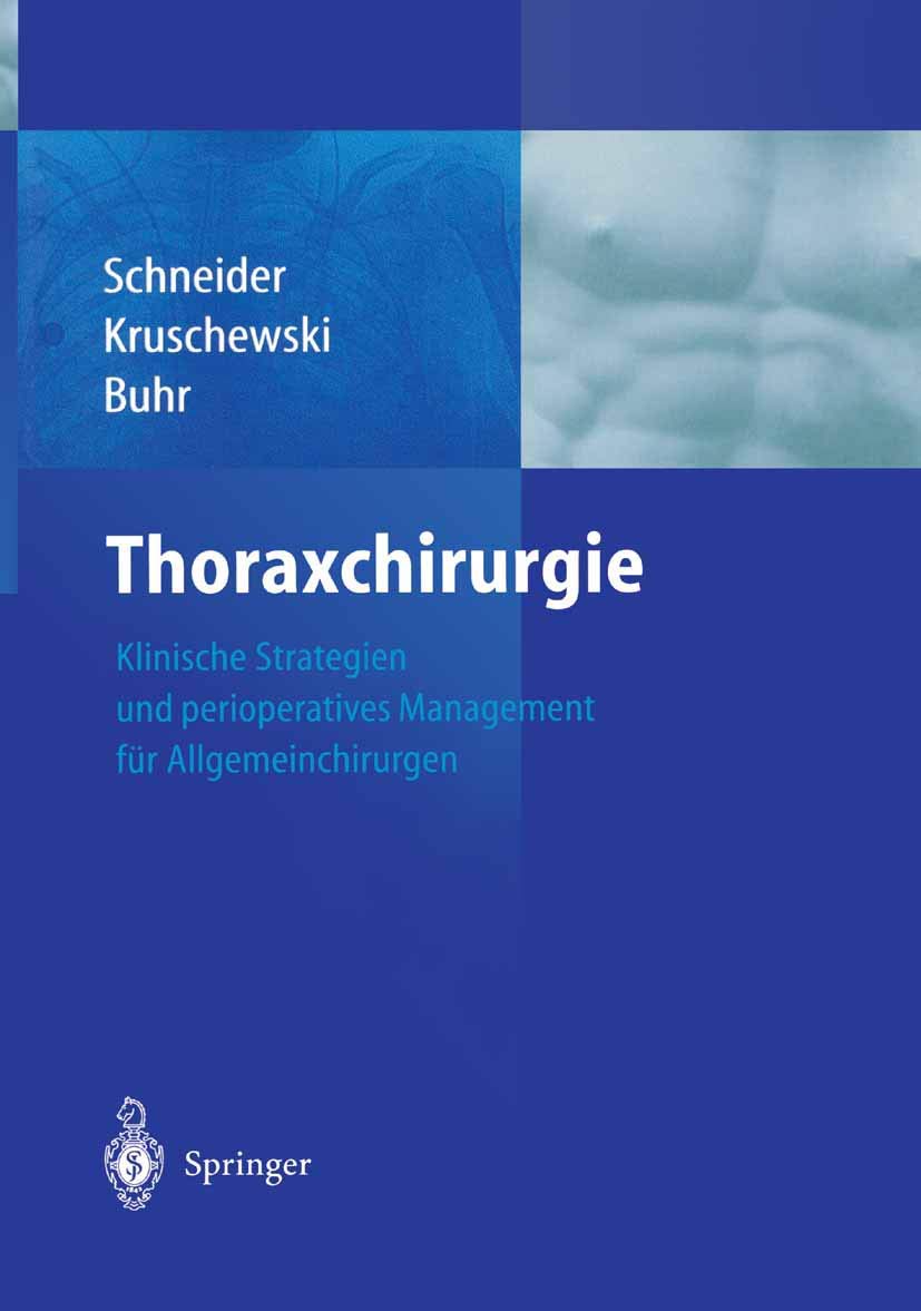 Thoraxchirurgie: Klinische Strategien und perioperatives Management für Allgemeinchirurgen Medicine
