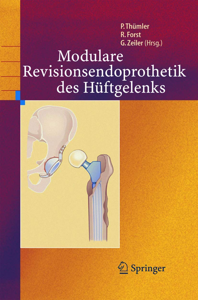 Modulare Revisionsendoprothetik des Hüftgelenks Medicine