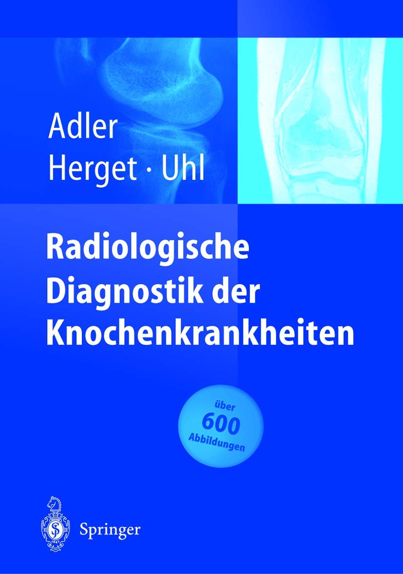 Radiologische Diagnostik der Knochenkrankheiten Medicine