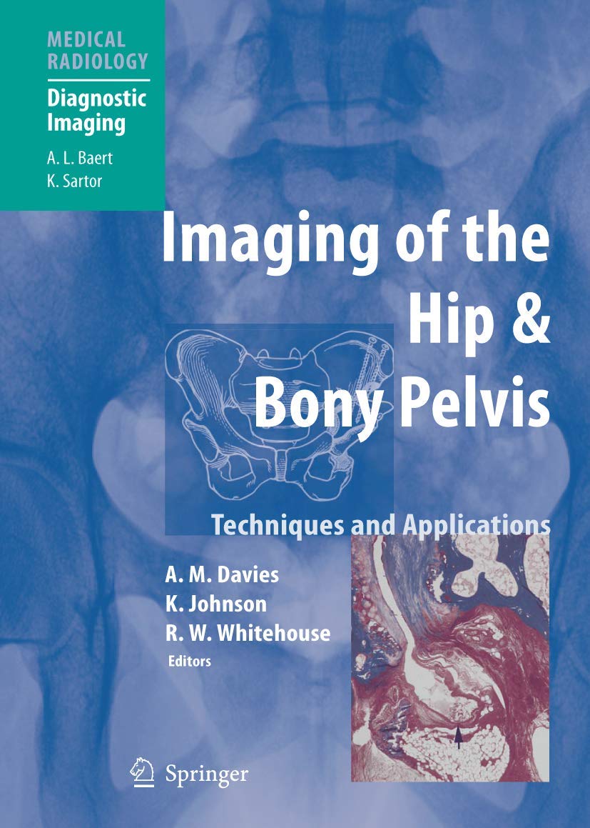 Imaging of the Hip & Bony Pelvis Medicine