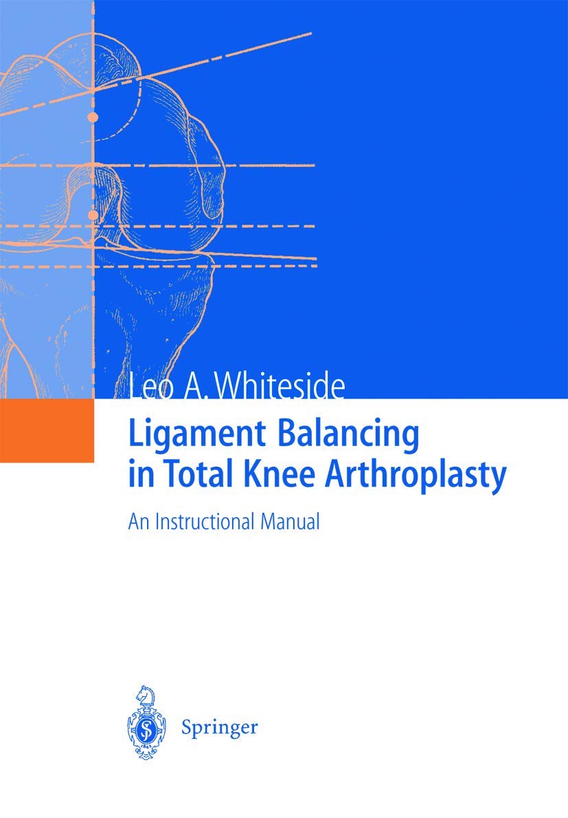 Ligament Balancing in Total Knee Arthroplasty: An Instructional Manual Medicine