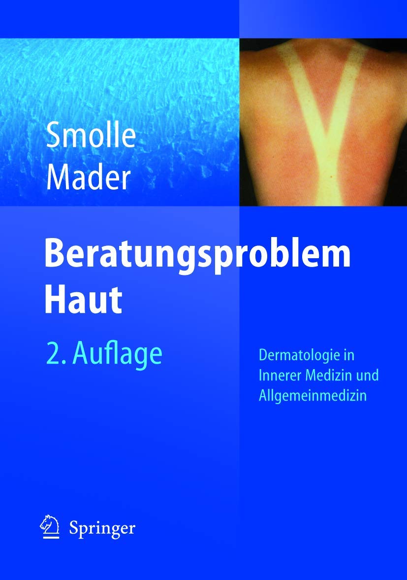 Beratungsproblem Haut: Dermatologie in Innerer Medizin und Allgemeinmedizin Medicine