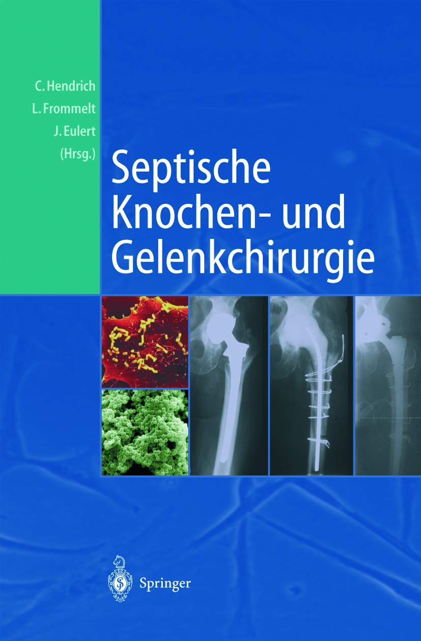 Septische Knochen-und Gelenkchirurgie Medicine