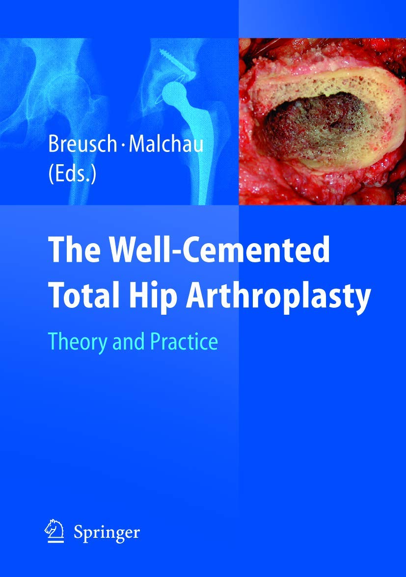 The Well-Cemented Total Hip Arthroplasty: Theory and Practice Medicine