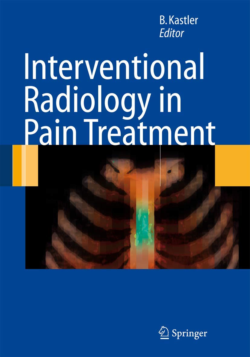 Interventional Radiology in Pain Treatment Medicine