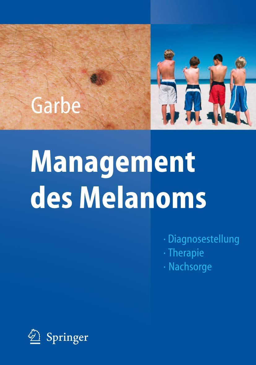 Management des Melanoms (Onkologie aktuell) Medicine