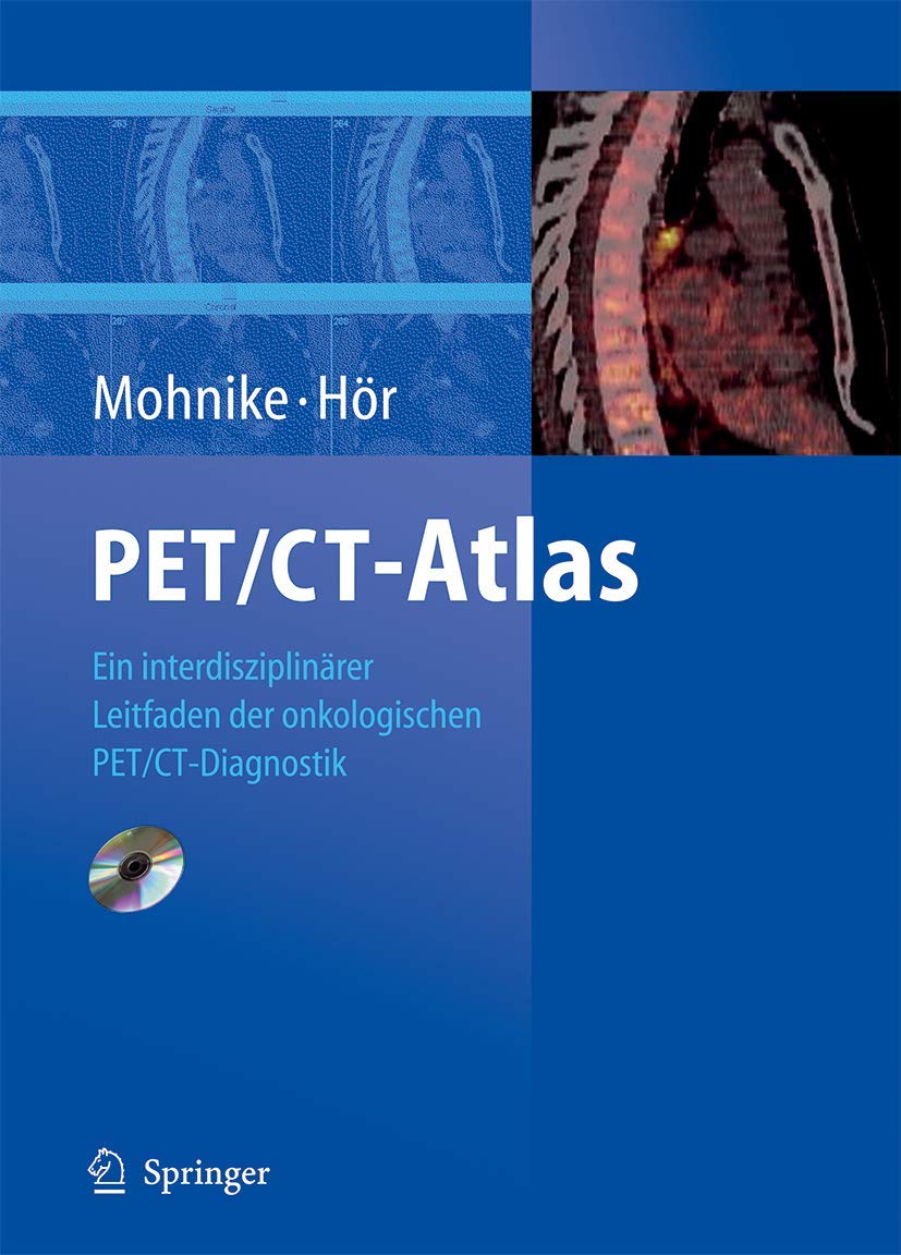 PET/CT-Atlas: Ein interdisziplinärer Leitfaden der onkologischen PET/CT-Diagnostik Medicine