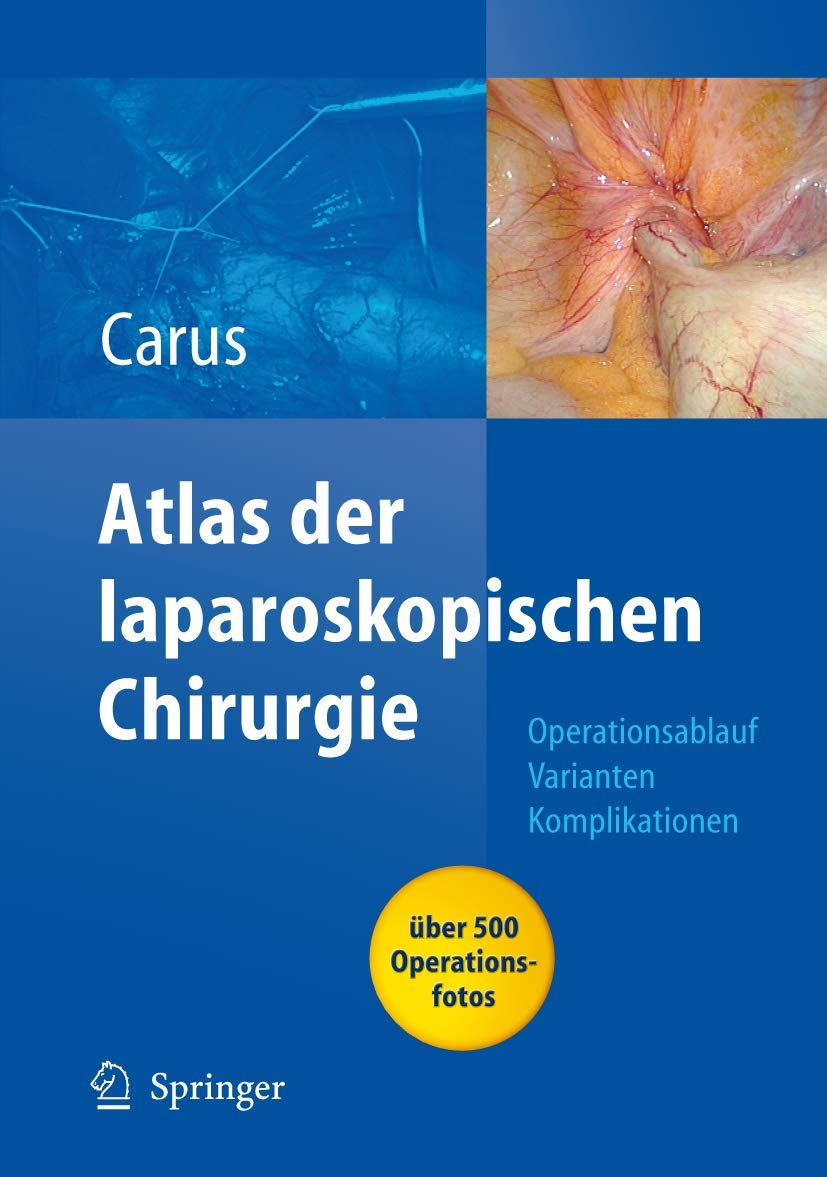 Operationsatlas Laparoskopische Chirurgie: Indikationen - Operationsablauf - Varianten - Komplikationen Mit Single Access Surgery Medicine