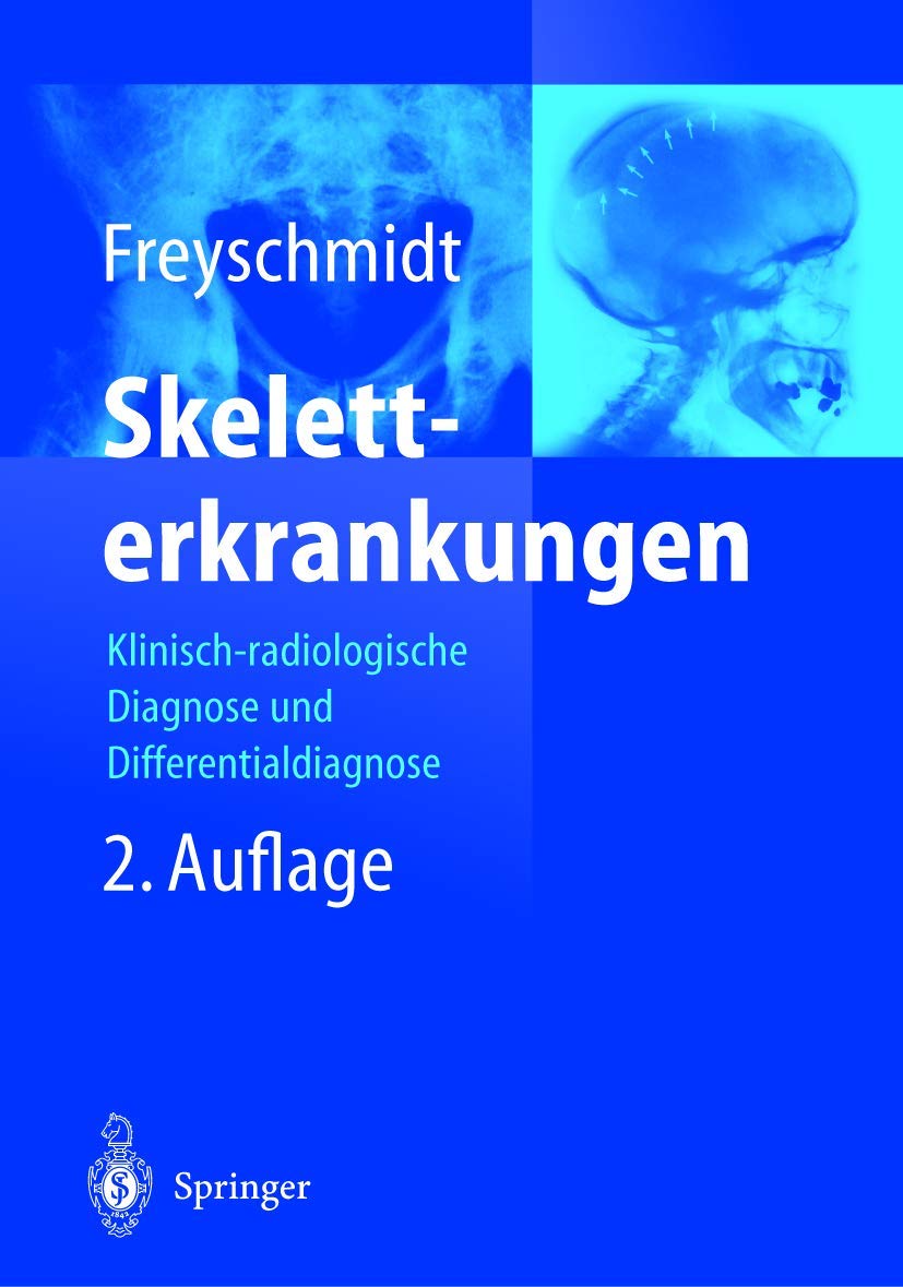 Skeletterkrankungen: Klinisch-radiologische Diagnose und Differentialdiagnose Medicine