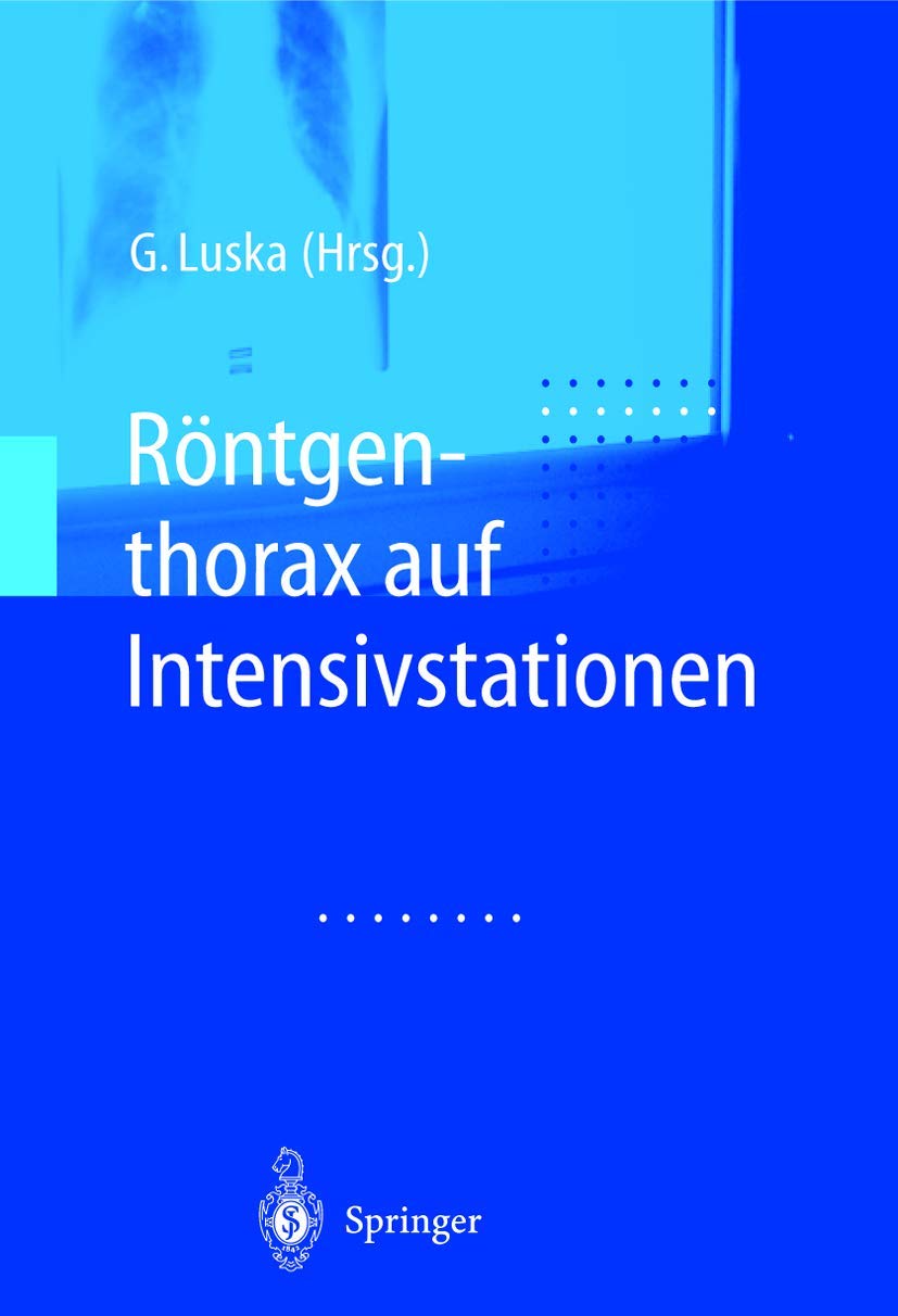 Röntgenthorax auf Intensivstationen Medicine