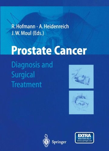 Prostate Cancer: Diagnosis and Surgical Treatment Medicine
