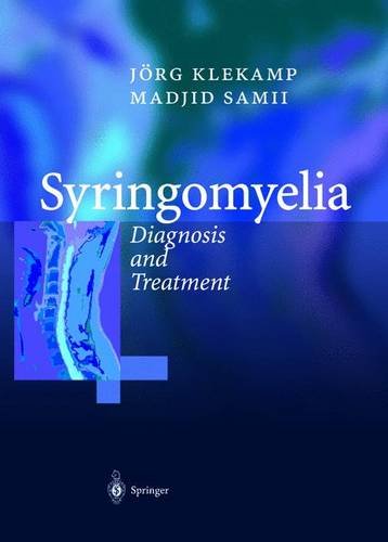 Syringomyelia: Diagnosis and Treatment Medicine