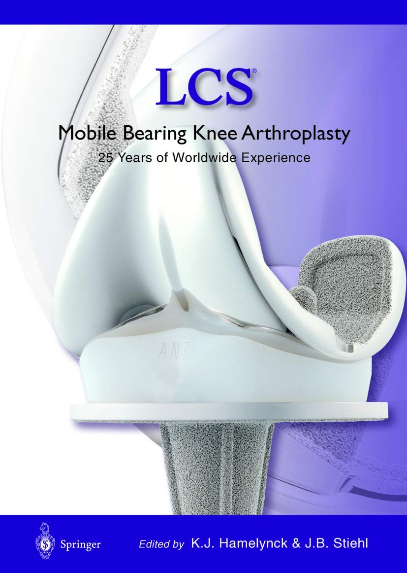 LCS® Mobile Bearing Knee Arthroplasty: A 25 Years Worldwide Review Medicine