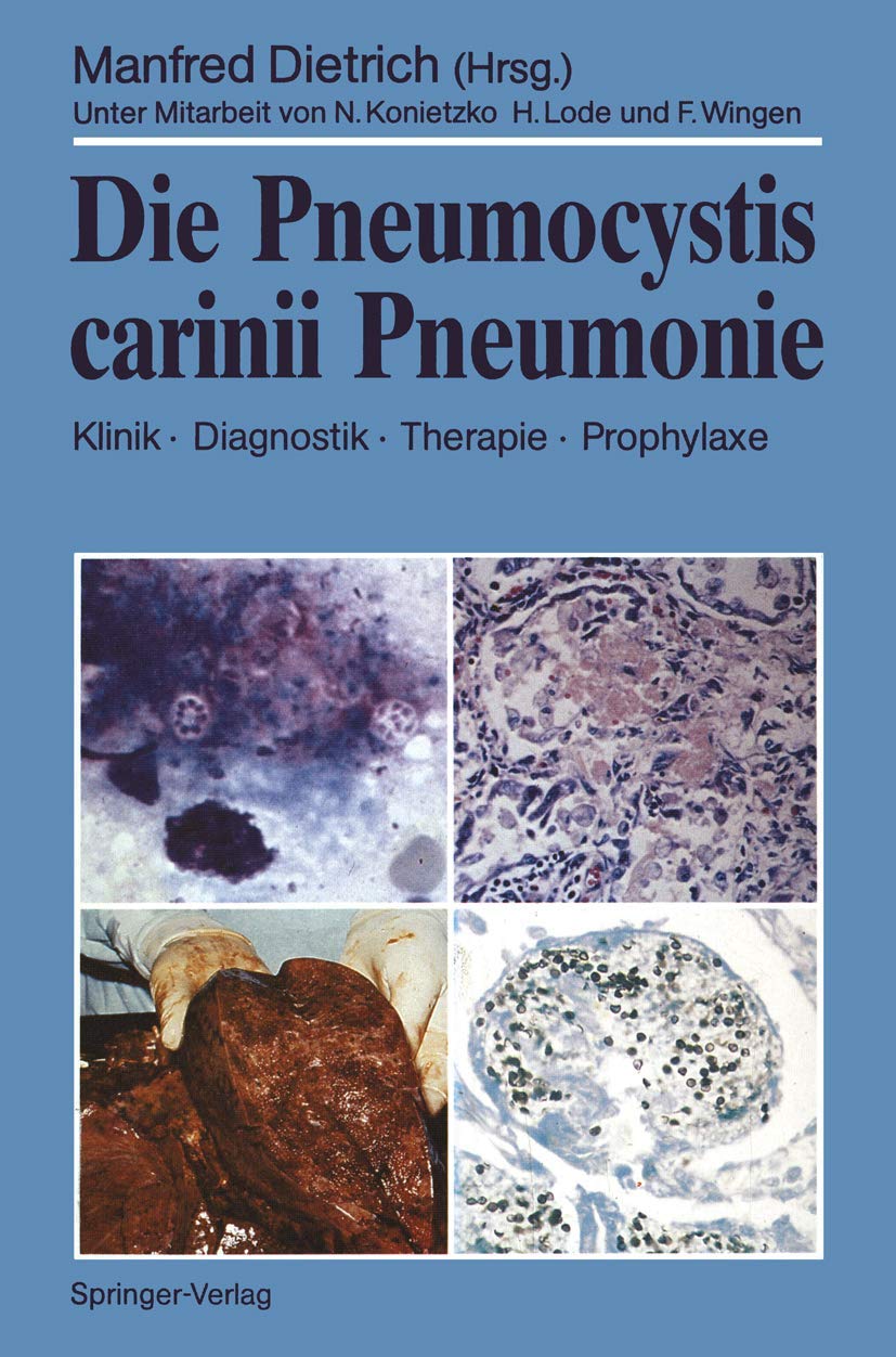 Die Pneumocystis carinii Pneumonie: Klinik · Diagnostik · Therapie · Prophylaxe Medicine