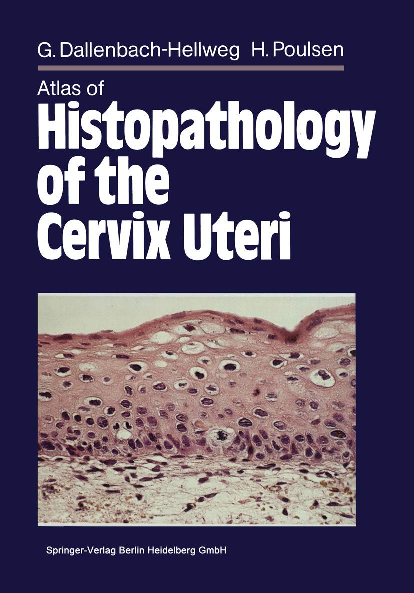 Atlas of Histopathology of the Cervix Uteri Medicine