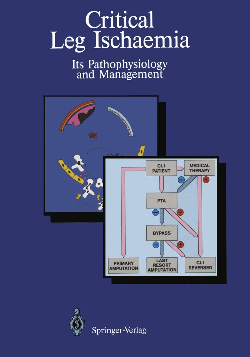 Critical Leg Ischaemia. Its Pathophysiology and Management Medicine