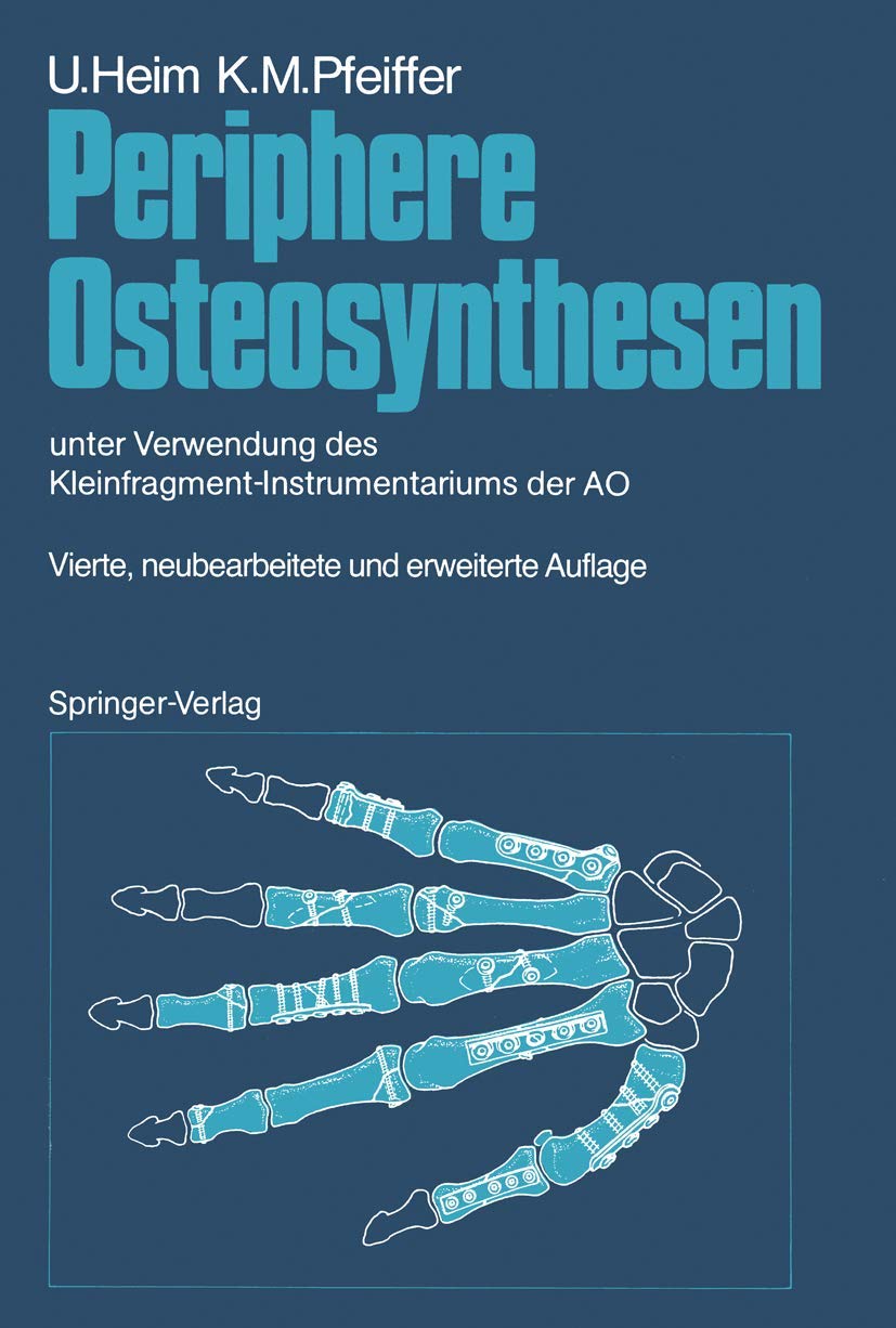 Periphere Osteosynthesen: unter Verwendung des Kleinfragment-Instrumentariums der AO Medicine