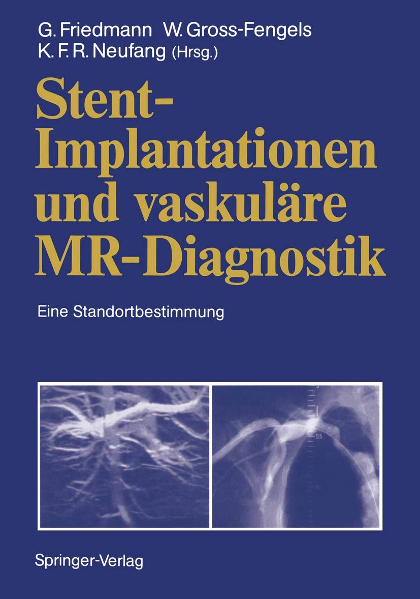 Stent-Implantationen und vaskuläre MR-Diagnostik: Eine Standortbestimmung Medicine