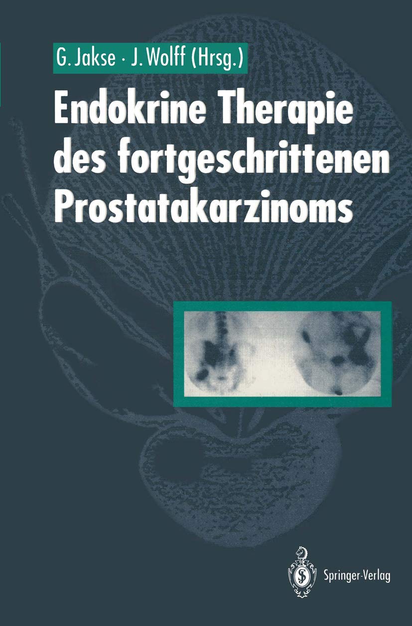 Endokrine Therapie des fortgeschrittenen Prostatakarzinoms Medicine