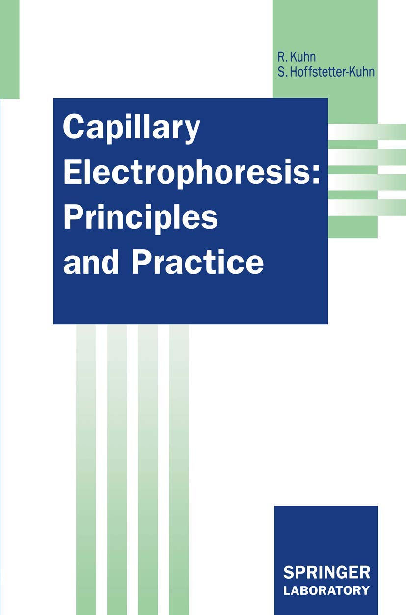 Capillary Electrophoresis: Principles and Practice (Springer Lab Manual) Business, Finance & Career