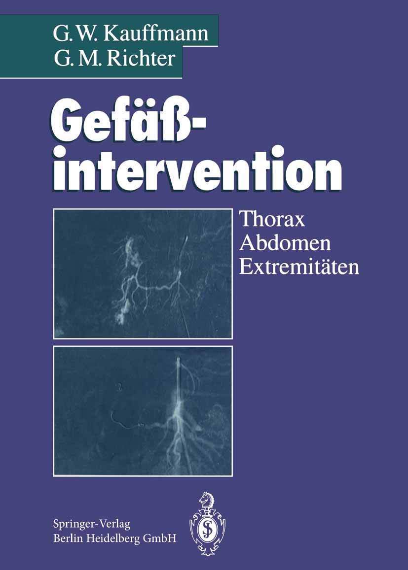 Gefäßintervention: Thorax, Abdomen, Extremitäten Medicine