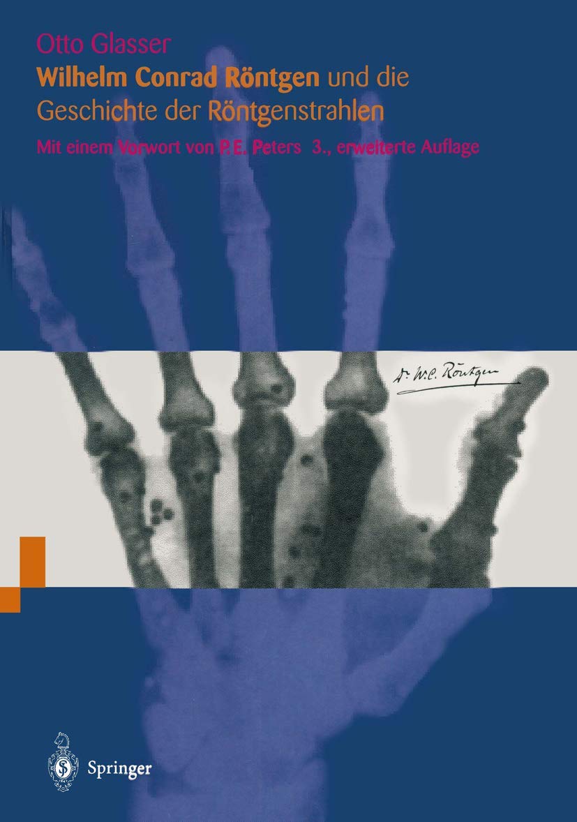 Wilhelm Conrad Röntgen und die Geschichte der Röntgenstrahlen Medicine