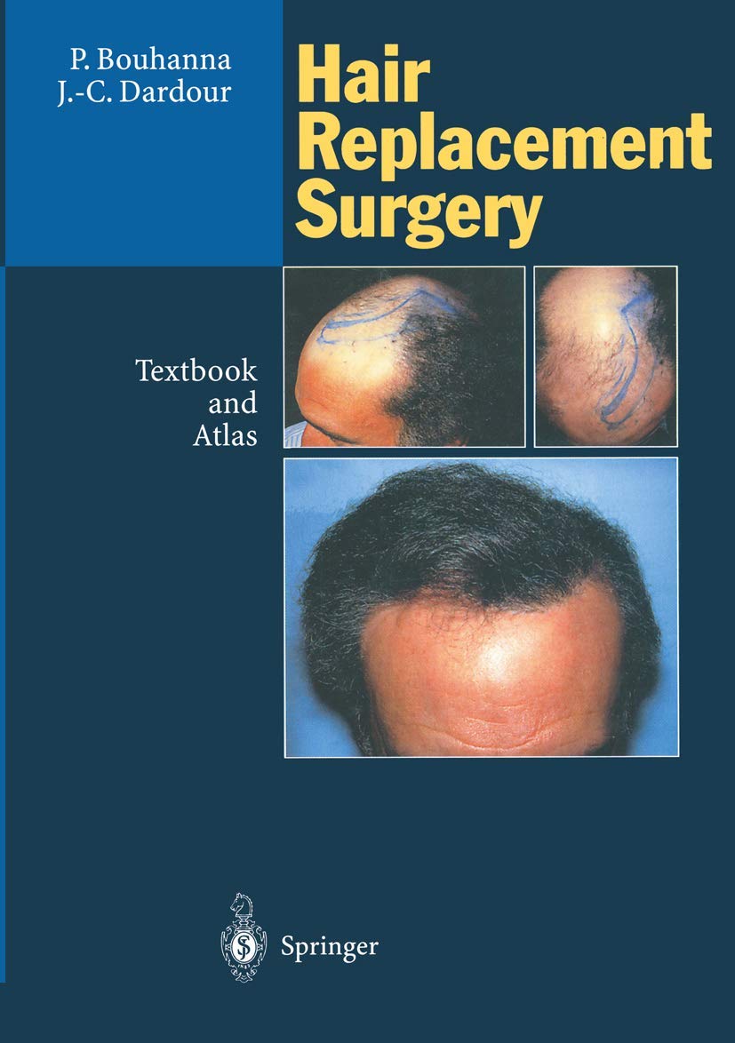 Hair Replacement Surgery: Textbook and Atlas Medicine