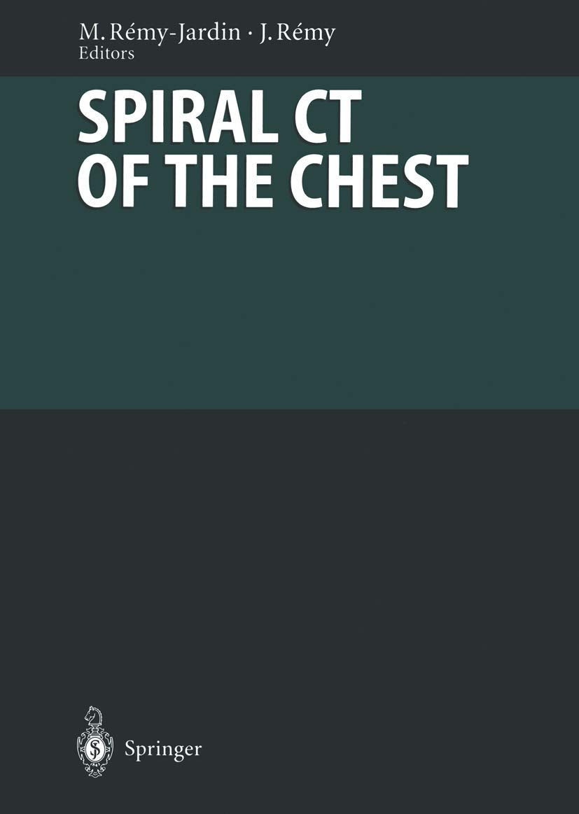 Spiral CT of the Chest: With Contributions by Numerous Experts (Diagnostic Imaging) Medicine