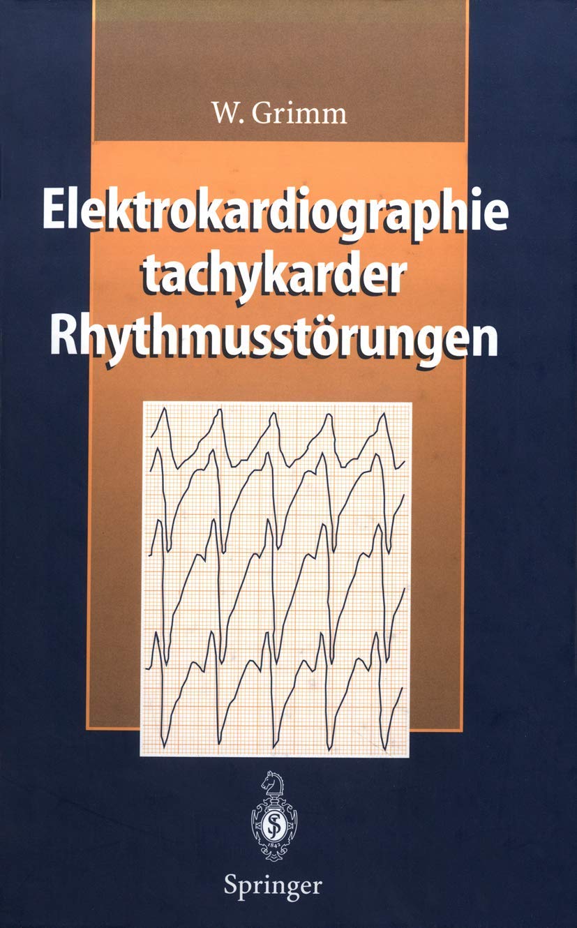 Elektrokardiographie tachykarder Rhythmusstörungen Medicine
