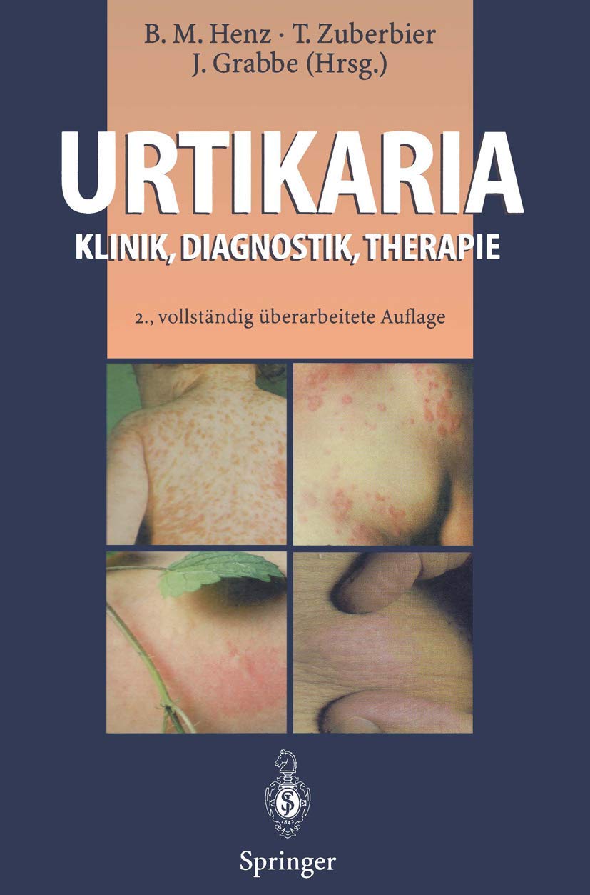 Urtikaria: Klinik, Diagnostik, Therapie Medicine