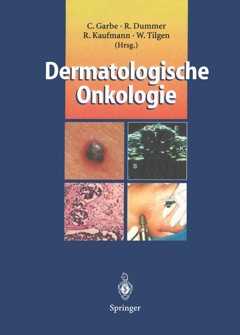 Dermatologische Onkologie Medicine