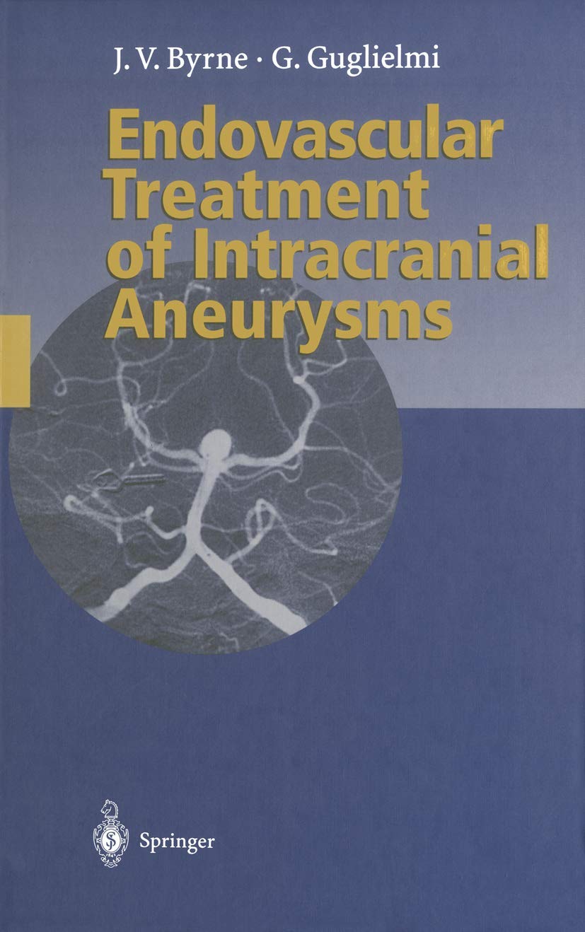 Endovascular Treatment of Intracranial Aneurysms Medicine