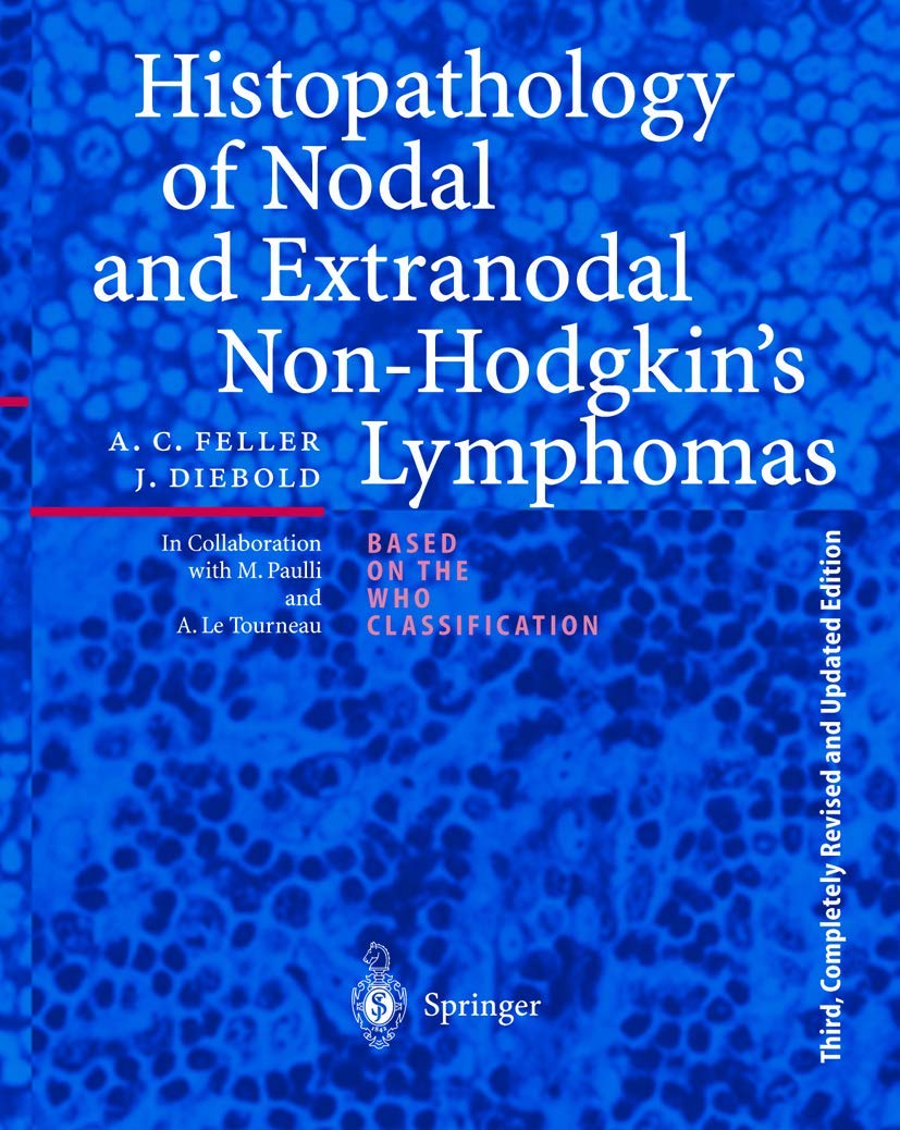 Histopathology of Nodal and Extranodal Non-Hodgkin's Lymphomas Medicine