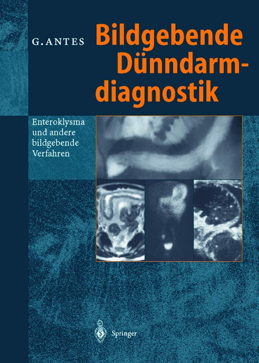 Bildgebende Dünndarmdiagnostik: Enteroklysma und andere bildgebende Verfahren Medicine