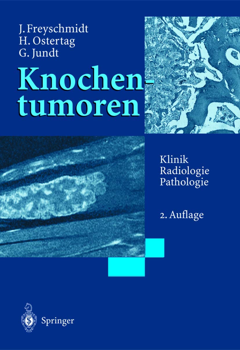 Knochentumoren mit Kiefertumoren: Klinik - Radiologie - Pathologie Medicine