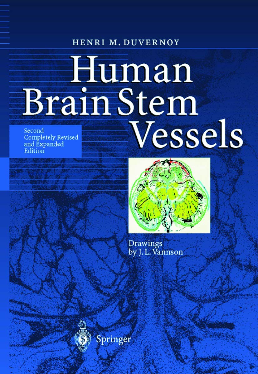 Human Brain Stem Vessels: Including the Pineal Gland and Information on Brain Stem Infarction Medicine