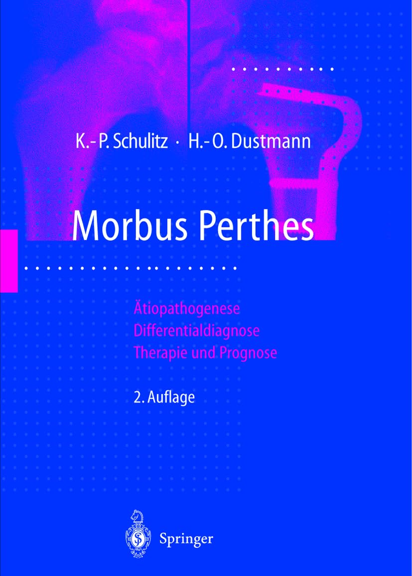Morbus Perthes: Ätiopathogenese, Differentialdiagnose, Therapie und Prognose Medicine