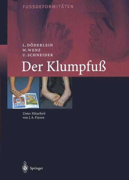 Der Klumpfuss: Erscheinungsformen und Behandlungsprinzipien jeden Alters. Differentialdiagnose und Differentialtherapie Medicine