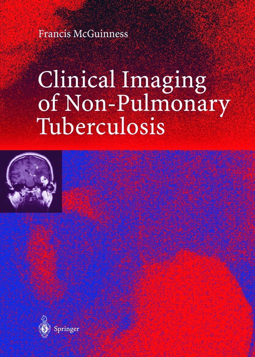 Clinical Imaging in Non-Pulmonary Tuberculosis Medicine