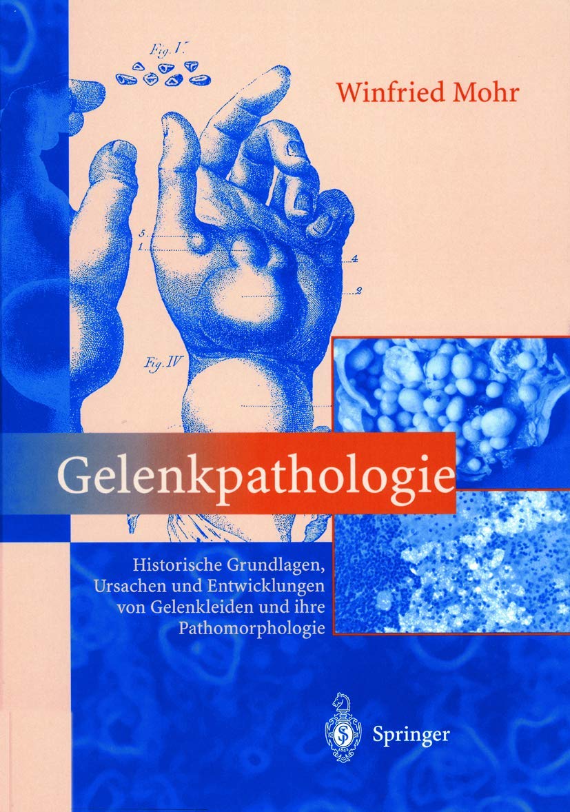 Gelenkpathologie: Historische Grundlagen, Ursachen und Entwicklungen von Gelenkleiden und ihre Pathomorphologie Medicine