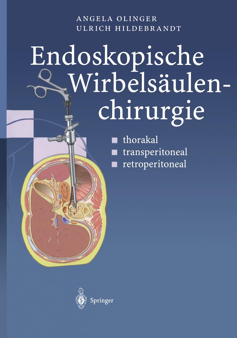 Endoskopische Wirbelsäulenchirurgie: thorakal · transperitoneal · retroperitoneal Medicine