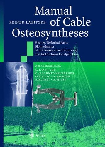 Manual of Cable Osteosyntheses: History, Technical Basis, Biomechanics of the Tension Band Principle, and Instructions for Operation Medicine