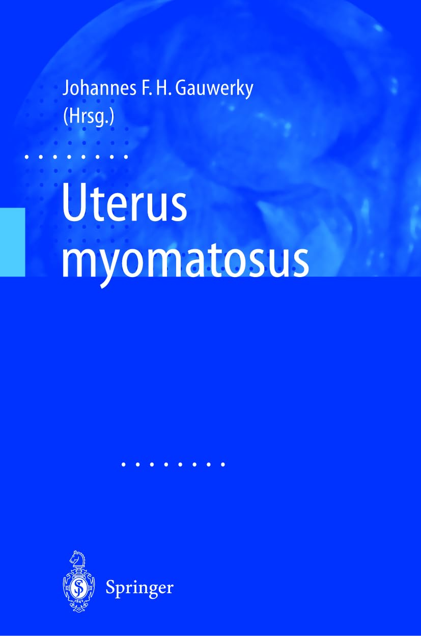 Uterus myomatosus Medicine
