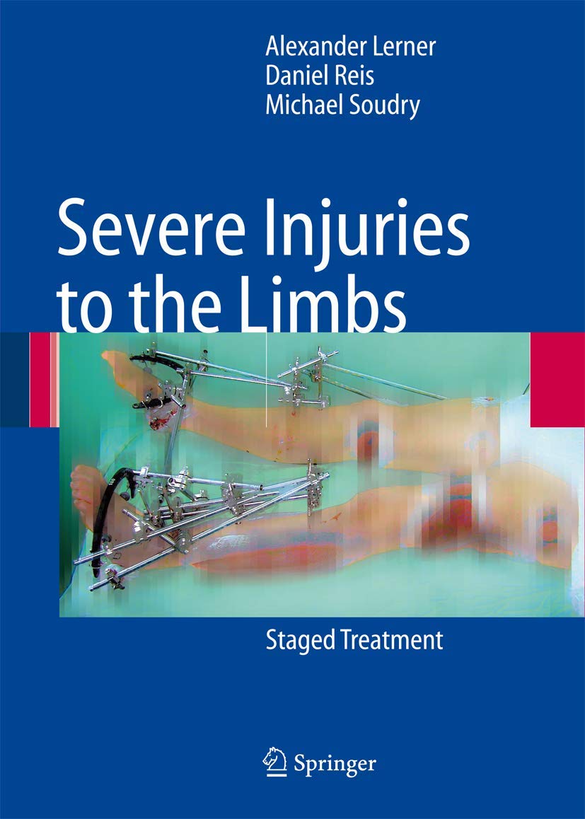 Severe Injuries to the Limbs: Staged Treatment Medicine
