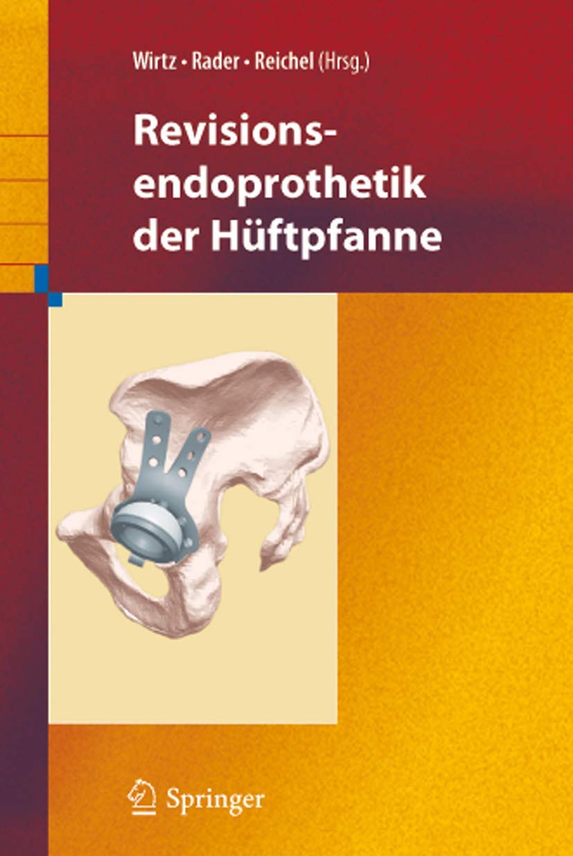 Revisionsendoprothetik der Hüftpfanne Medicine