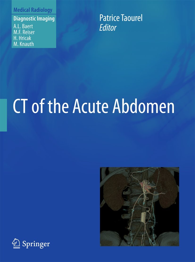 CT of the Acute Abdomen book