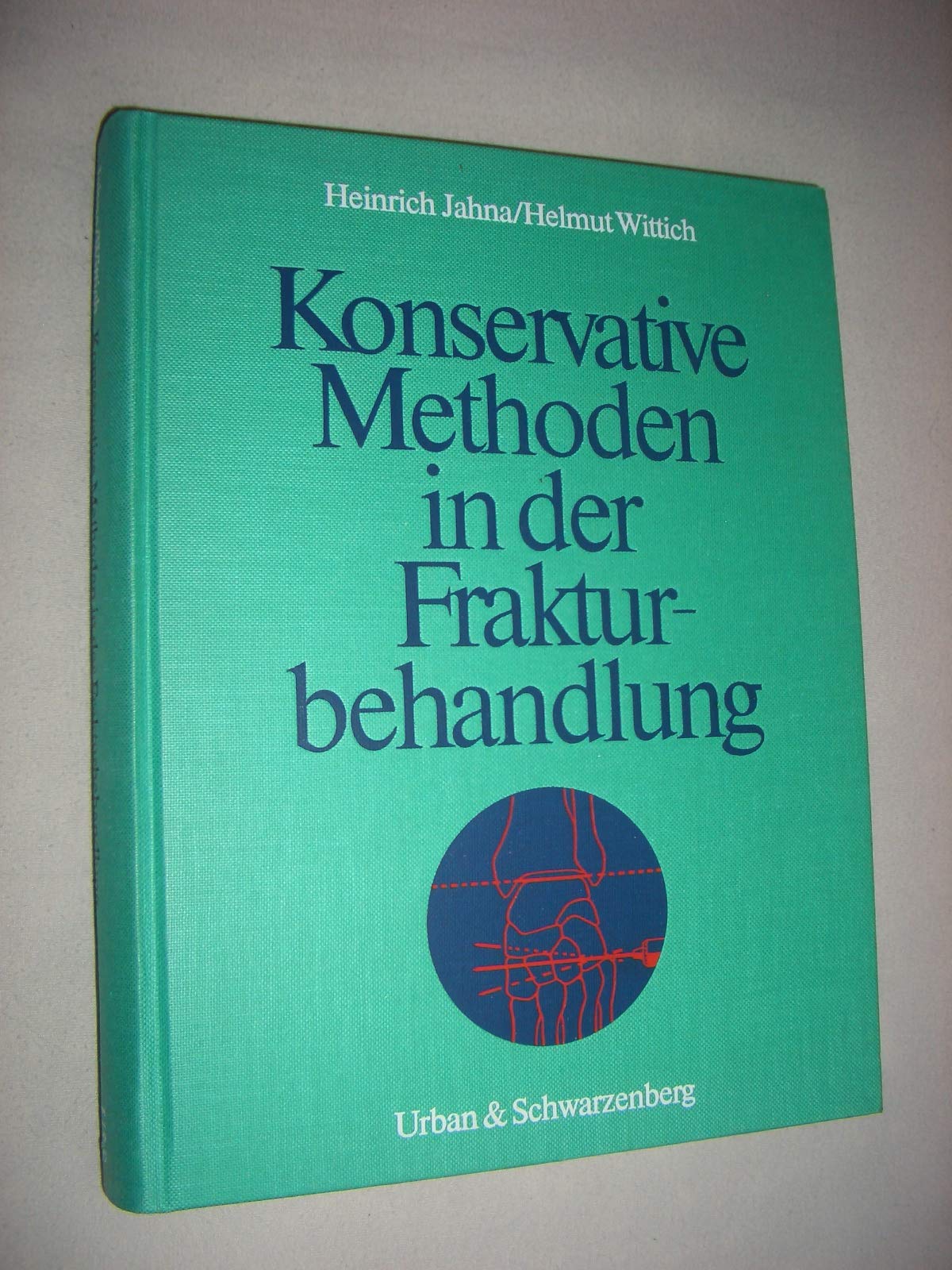 Konservative Methoden in der Frakturbehandlung Medicine